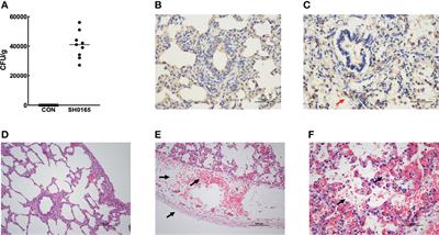 Pleural thickening induced by Glaesserella parasuis infection was linked to increased collagen and elastin